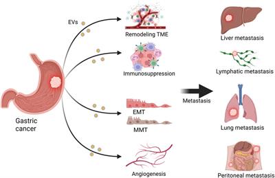 The biological role of extracellular vesicles in gastric cancer metastasis